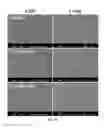 Fig. 26 - Application of the newly developed technology in stainless steel for biomedical implant