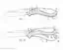 Fig. 05 - Folding tool adapted for simple assembly and disassembly