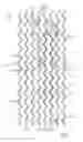Fig. 16 - Methods for solid phase processing of tubes and medical devices made from the processed tubes