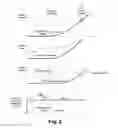 Fig. 03 - Method and device for controlling the restarting of a vehicle provided with an automatic transmission