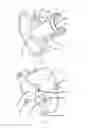 Fig. 09 - Automobile active steering system with cycloidal-pin wheel mechanism