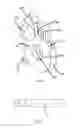 Fig. 12 - Automobile active steering system with cycloidal-pin wheel mechanism