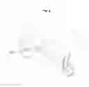 Fig. 05 - Steering mechanism for pedal driven vehicle