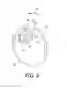 Fig. 06 - Bicycle crank assembly