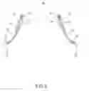 Fig. 03 - Adjustable circumferential seal