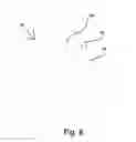 Fig. 06 - Balloon anchor