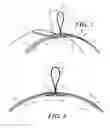 Fig. 04 - Cylindrical container with side-mount hang tab and methods therefor