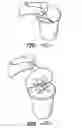 Fig. 10 - Peel-away shaker can and can membrane