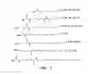 Fig. 05 - Covalent tethering of functional groups to proteins