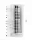 Fig. 03 - Nucleic acid purification