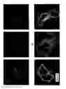 Fig. 07 - SMALL MOLECULE MODULATORS OF PCSK9 AND METHODS OF USE THEREOF