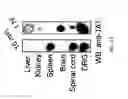 Fig. 43 - MATERIALS AND METHOD FOR SUPPRESSING INFLAMMATORY AND NEUROPATHIC PAIN