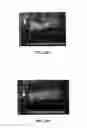 Fig. 82 - MATERIALS AND METHOD FOR SUPPRESSING INFLAMMATORY AND NEUROPATHIC PAIN