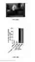 Fig. 83 - MATERIALS AND METHOD FOR SUPPRESSING INFLAMMATORY AND NEUROPATHIC PAIN