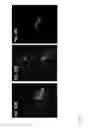 Fig. 16 - Recombinantly expressed plasmodium CelTOS antigen and methods of use thereof