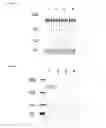 Fig. 13 - METHODS AND COMPOSITIONS USEFUL IN MANIPULATING THE STABILITY OF RE1 SILENCING TRANSCRIPTION FACTOR
