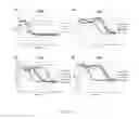 Fig. 59 - Methods and compositions with a recombinant neutralizing binding protein for treating toxin exposure