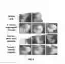 Fig. 20 - Treatment of staphylococcal disorders