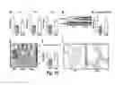 Fig. 12 - Methods for treating osteogenesis imperfecta