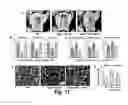 Fig. 13 - Methods for treating osteogenesis imperfecta