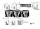 Fig. 15 - Methods for treating osteogenesis imperfecta