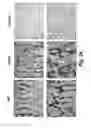 Fig. 26 - Methods for treating osteogenesis imperfecta