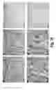 Fig. 28 - Methods for treating osteogenesis imperfecta