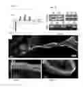 Fig. 02 - Methods for Promoting Reinnervation of Auditory Hair Cells