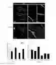 Fig. 04 - Methods for Promoting Reinnervation of Auditory Hair Cells