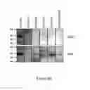 Fig. 10 - ANTI IL-3R ALPHA AGENTS AND USES THEREOF