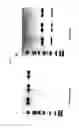 Fig. 03 - Stable compositions of high-concentration allotype-selected antibodies for small-volume administration