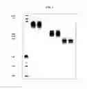 Fig. 04 - Stable compositions of high-concentration allotype-selected antibodies for small-volume administration