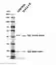 Fig. 04 - Method for preparing glycan-hydrolyzed antibody, and homogeneous glycosylated antibody