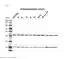 Fig. 15 - Method for preparing glycan-hydrolyzed antibody, and homogeneous glycosylated antibody