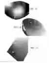 Fig. 09 - Thermoformed structural composites