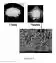 Fig. 05 - A METHOD FOR MAKING AN OPTICAL ASSEMBLY COMPRISING DEPOSITING A SOLID SILICONE-CONTAINING HOT MELT COMPOSITION IN POWDER FORM AND FORMING AN ENCAPSULANT THEREOF