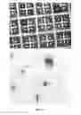 Fig. 13 - Cell culture device