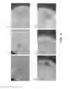 Fig. 11 - Conical devices for three-dimensional aggregate(s) of eukaryotic cells