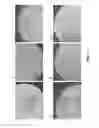 Fig. 12 - Conical devices for three-dimensional aggregate(s) of eukaryotic cells