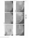 Fig. 13 - Conical devices for three-dimensional aggregate(s) of eukaryotic cells