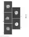 Fig. 16 - Conical devices for three-dimensional aggregate(s) of eukaryotic cells