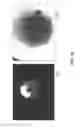Fig. 17 - Conical devices for three-dimensional aggregate(s) of eukaryotic cells