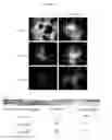 Fig. 03 - Compositions and methods for obtaining enriched mesenchymal stem cell cultures