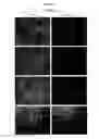 Fig. 06 - Compositions and methods for obtaining enriched mesenchymal stem cell cultures