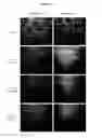 Fig. 12 - Compositions and methods for obtaining enriched mesenchymal stem cell cultures