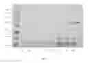 Fig. 06 - UREASE PURIFICATION FROM JACK BEANS OR OTHER ORGANISMS