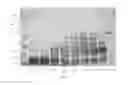 Fig. 08 - UREASE PURIFICATION FROM JACK BEANS OR OTHER ORGANISMS