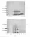 Fig. 10 - UREASE PURIFICATION FROM JACK BEANS OR OTHER ORGANISMS