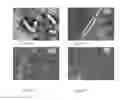 Fig. 06 - ENCAPSULATION OF BACTERIA AND VIRUSES IN ELECTROSPUN FIBERS