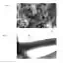 Fig. 08 - ENCAPSULATION OF BACTERIA AND VIRUSES IN ELECTROSPUN FIBERS